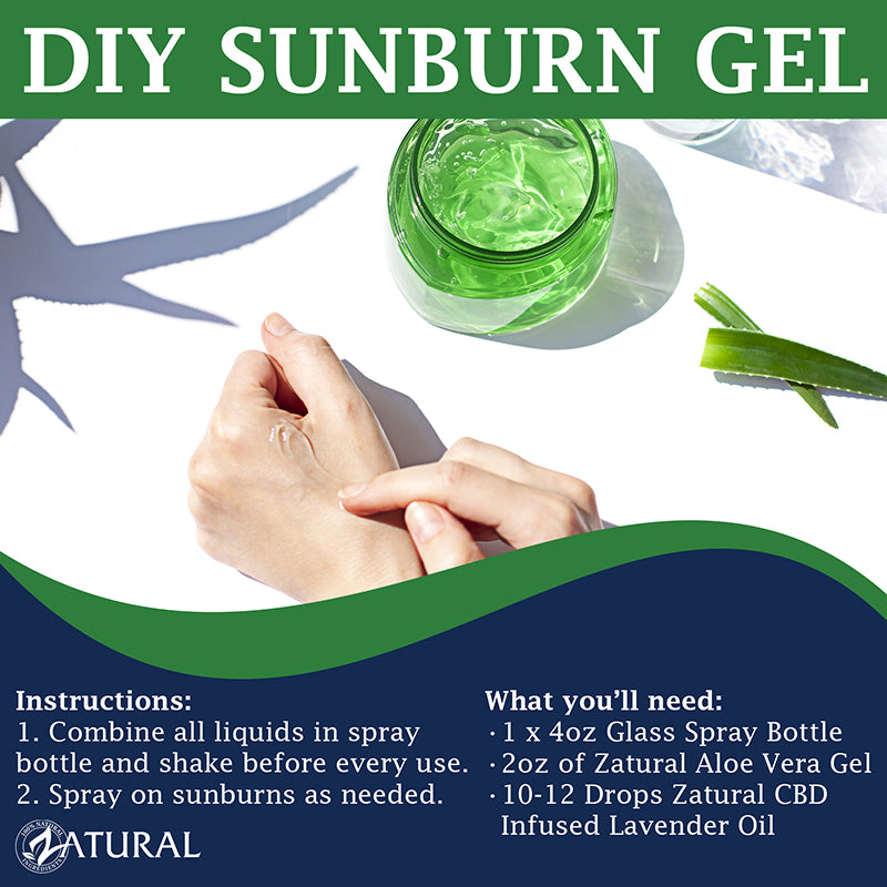 DIY Sunburn Gel graphic